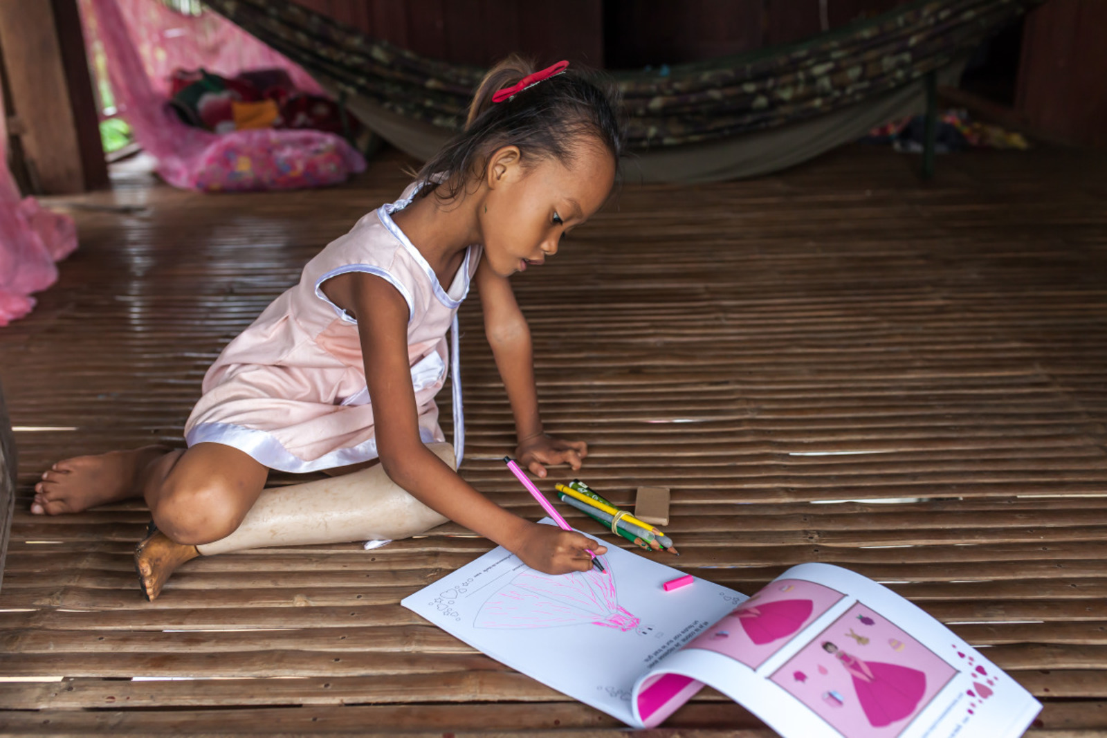 Channa, 7 ans, amputée congénitale et bénéficiaire de HI