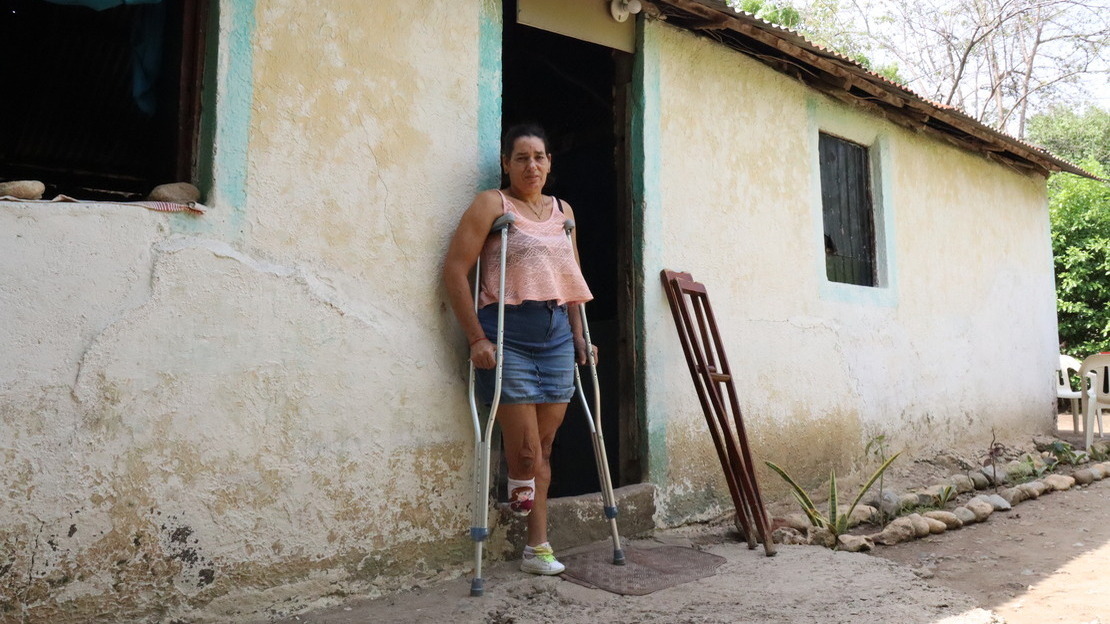 A woman stands leaning against the entrance to a cement house. She is leaning on crutches, her right leg amputated below the knee. ; }}