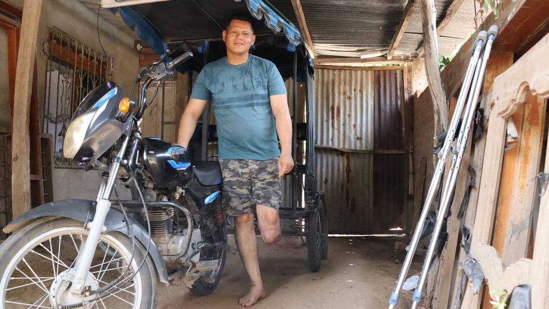 In a wooden and tin shed, a man stands, leaning on a motorcycle connected to a cariole with a seat. The man smiles, his left leg cut off below the knee.; }}